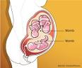 Womb