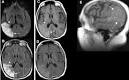 <b>Middle Cerebral Artery</b>