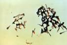 File:Clostridium <b>tetani</b> 01.png