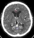 Computed Tomography (CT) Scans
