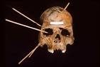 Forensic Anthropology