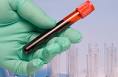 Explain that <b>serologic tests</b>
