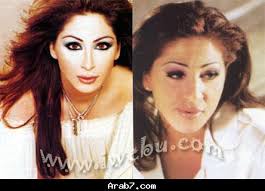 الفنانات قبل عملية التجميل ومن دون مكياج Images?q=tbn:ANd9GcTMaKGugQkXBsJZ4SVySkgQ8d6eGwvQPU0uhgHfudfNZEKyGgyO