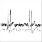 DSP Web Example