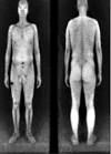 EPIC - Body Scanner FAQ