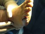 <b>Smooth muscle tumors</b>.