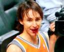 Steve Nash's face was bloodied by Earl Watson of the Pacers. - images?q=tbn:ANd9GcTP2OmI9O2F0i5wPcvPyXcxjE4ixwqYoXuQBoF69wcCin7U9SiRT9y8xgk