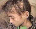 Samia, victim of family violence in fundamentalists-dominated Afghanistan - images?q=tbn:ANd9GcTP3EpAzYKIcYJadMKjHeQZz4ewD7DLuoMMCyKb7BHyf-wE9lRa6xLeGw