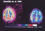 http://www.winmentalhealth.com/images/help-for-adhd.jpg