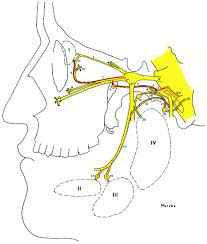 trigemino