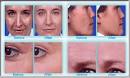 Face Microdermabrasion and Home Facial Masks