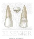 Maxillary Central Incisor (Right Side) - Netter Medical Images
