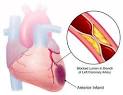 Missed Opportunity in the Treatment of Hyperlipidemia in Patients ...