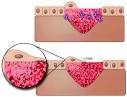 <b>CICATRIZACION</b> DE LAS <b>HERIDAS</b>