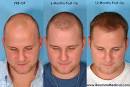 hair-