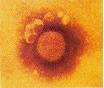 The Big Picture Book of Viruses - Arenaviruses