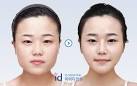 the left one has square jaw