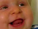Nystagmus Jake Wood