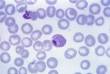 <b>Plasmodium vivax</b>