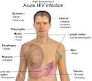 of acute <b>HIV infection</b>.