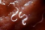 File:Hookworms.JPG - Wikipedia, the free encyclopedia