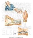 (<b>de Quervain's Disease</b>)