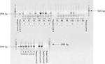 High prevalence of Mycobacterium avium subspecies paratuberculosis ...