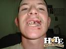 Is It Bad For Teeth?