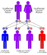 Cause [edit]. <b>Thalassemia</b>