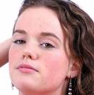 What are blemishes and how do the form?