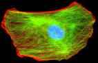 Cytoskeleton | Basic Science Partnership at Harvard Medical School