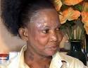 Jamaicas Bleaching Epidemic is Now Known Globally