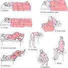 lithotomy position - definition of lithotomy position in the ...
