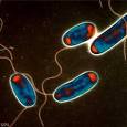 Legionellosis (Legionnaires' disease) | Humen Healths