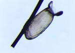 Ectoparasite Control