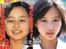 芸能人が美容整形手術を受け