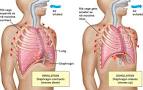 Craniosacral Therapy — Difficulty Breathing (Dyspnea) | Oregon ...