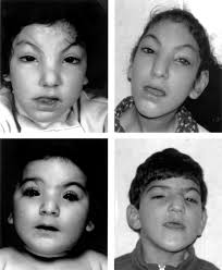 Шокирующая правда про Аватар, или Истинный диагноз На'Ви 