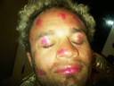 "7 & 8 year old girls got me when I was napping today!