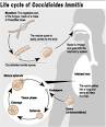 Valley Fever is not contagious