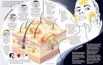 ACNE COSMETICA - Tudo sobre acne cosmética