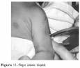 Bolet&Atilde;&shy;n m&Atilde;&copy;dico del Hospital Infantil de M&Atilde;&copy;xico - Mediciones <b>...</b>