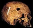 Forensic anthropology explained | Crime Scene Investigator (CSI ...