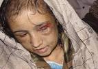 Muestra de las torturas en el rostro de Sara Gul. Foto: Jawed Basharat | AP - 657478_1