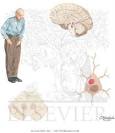 Extrapyramidal Disorders (Parkinson's Disease) - Netter Medical ...
