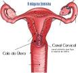 O <b>colo</b> uterino deve se manter