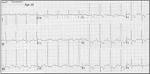 <b>Right Ventricular Hypertrophy</b>
