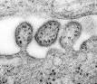 Arenavirus - Wikipedia, the free encyclopedia