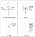 File:FGM Types german.svg - Wikimedia Commons