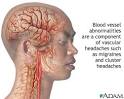 Blood Vessel Compression Neck Tension Headaches - HealthCentral